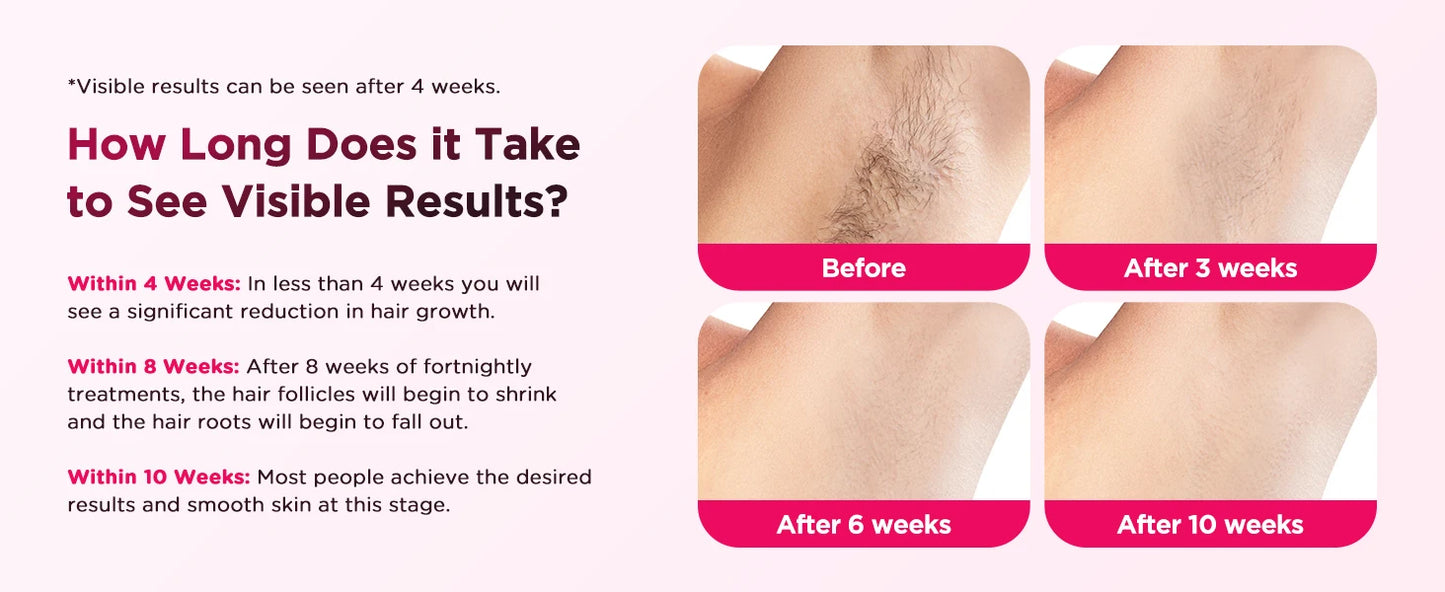 InzysLaserIPL - Compact IPL Hair Removal Laser with Ice Cooling 6.0