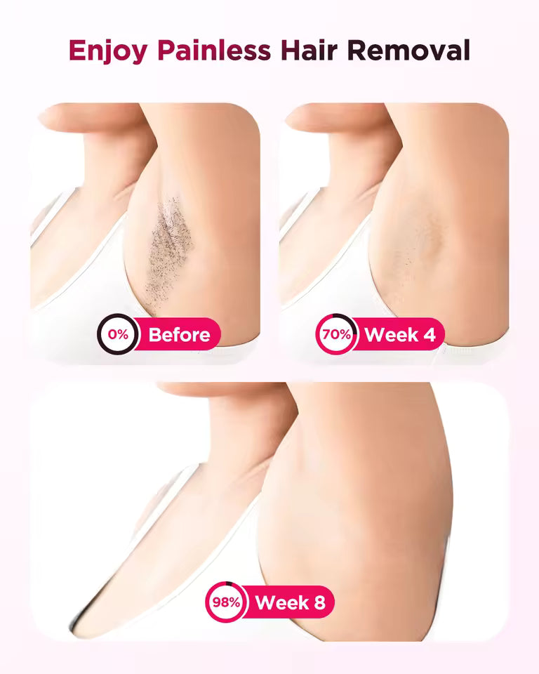 InzysLaserIPL - Compact IPL Hair Removal Laser with Ice Cooling 6.0