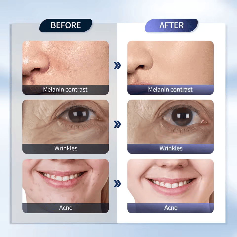 InzysJointRelief - 7 - Color LED Face Mask Light Therapy for Skin Rejuvenation - InzysJointRelief