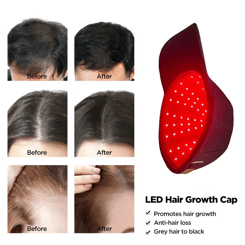 InzysJointRelief - Cold Laser Red Light Therapy Cap for Hair Growth - InzysJointRelief