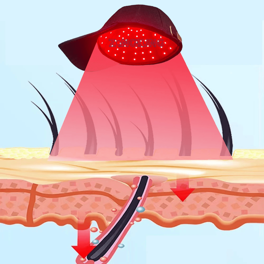 InzysJointRelief - Cold Laser Red Light Therapy Cap for Hair Growth - InzysJointRelief