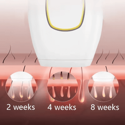 InzysJointRelief - IPL Laser Hair Removal Handset