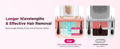 InzysLaserIPL - Compact IPL Hair Removal Laser with Ice Cooling 6.0