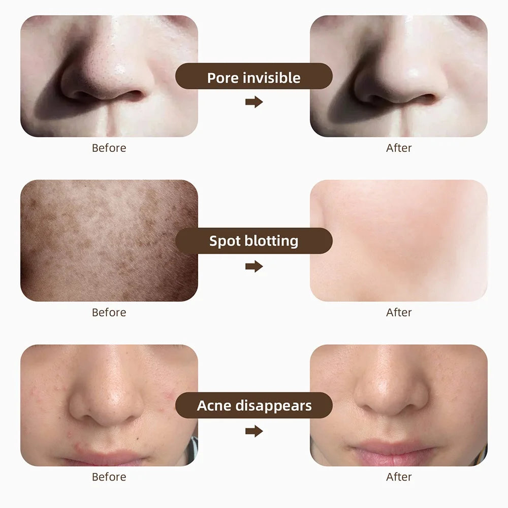 Wireless LED Facial Mask – 7 Color Photon Light Therapy Skin Care Machine