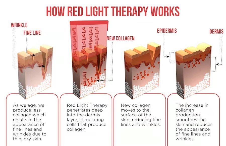 InzysJointRelief - Medical LED Infrared Light Therapy Device - InzysJointRelief