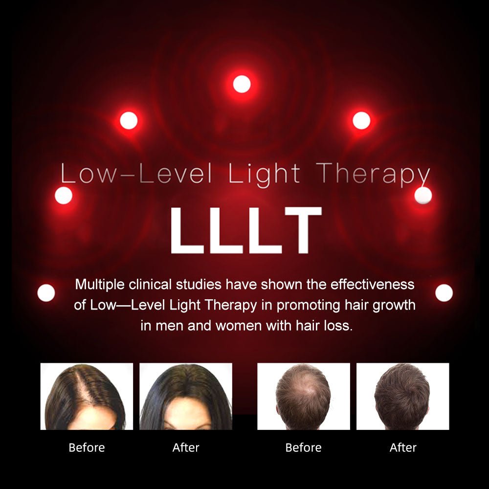 InzysJointRelief - Red Light Therapy Hair Growth Treatment for Head & Scalp at Home - InzysJointRelief