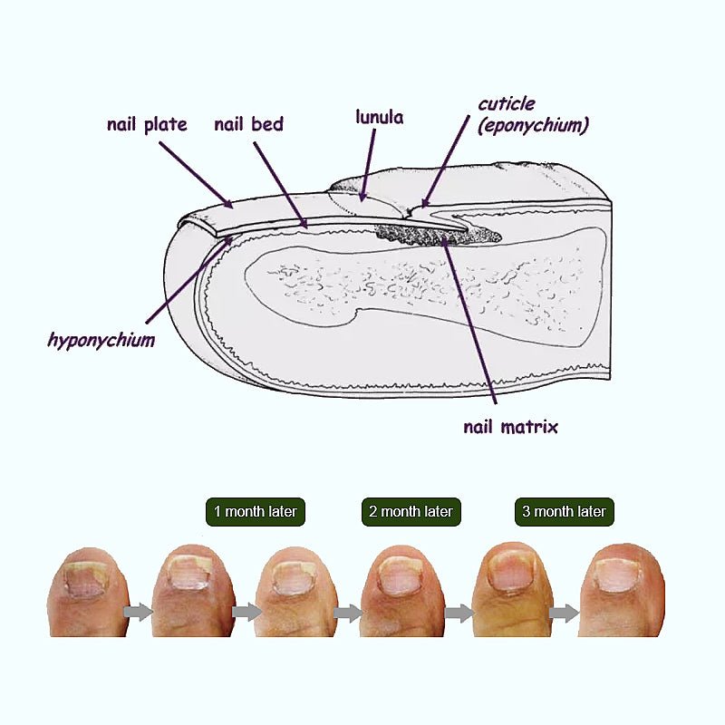 InzysJointRelief - Toenail Fungus Laser Therapy Device - InzysJointRelief