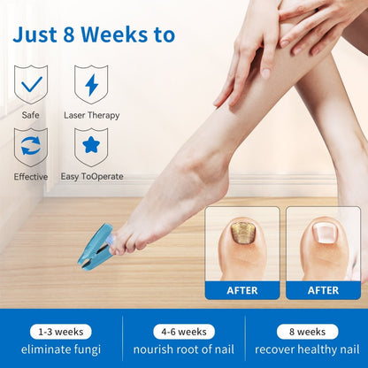 InzysJointRelief - Toenail Fungus Laser Therapy Device for Onychomycosis - InzysJointRelief