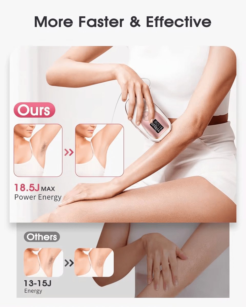 InzysLaserIPL - IPL Laser Hair Removal Device with Ice Cooling 2.0 - InzysJointRelief