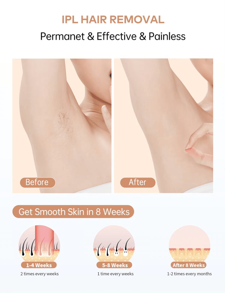 InzysLaserIPL - Professional IPL Hair Removal Laser 3.0 - InzysJointRelief