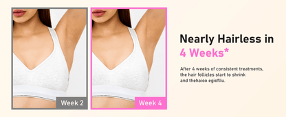 InzysLaserIPL - Professional IPL Hair Removal Laser 5.0 - InzysJointRelief